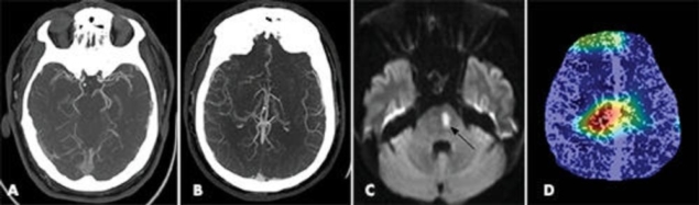 False-positive prediction