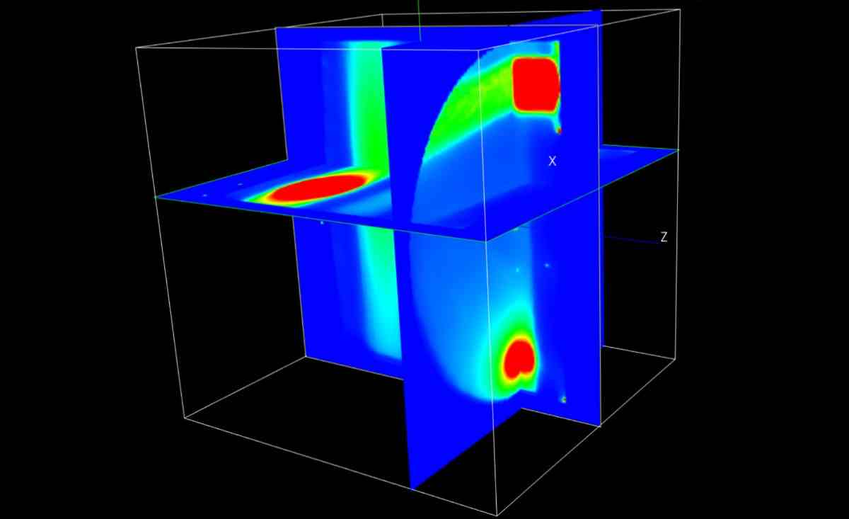 Joined-up thinking targets multiple-lesion dosimetry - Physics World