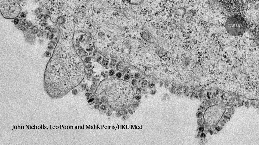 Coronavirus latest: global infections surge past 30,000