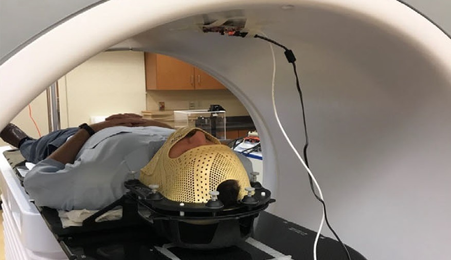 Millimetre waves monitor patient motion during radiotherapy - Physics World