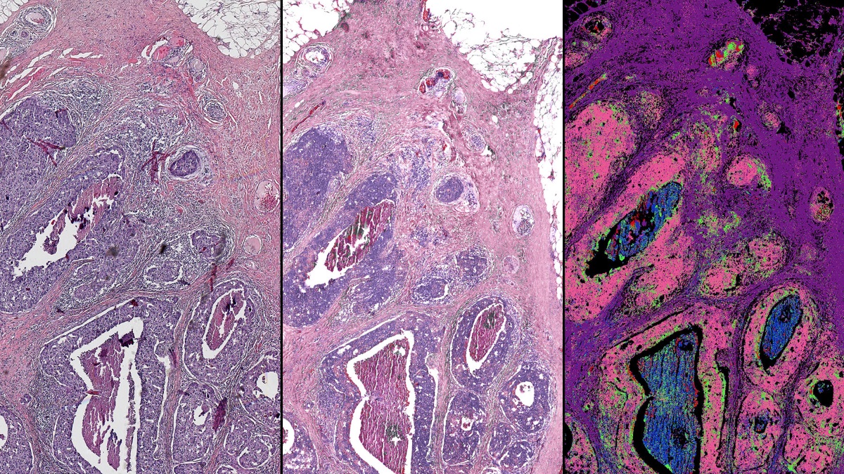 Hybrid infraredoptical microscope could improve cancer diagnostics - Physics World