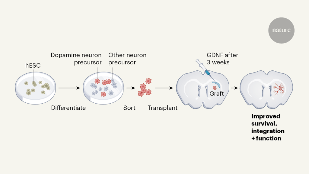 Parkinsons disease grafts benefit from well-timed growth factor